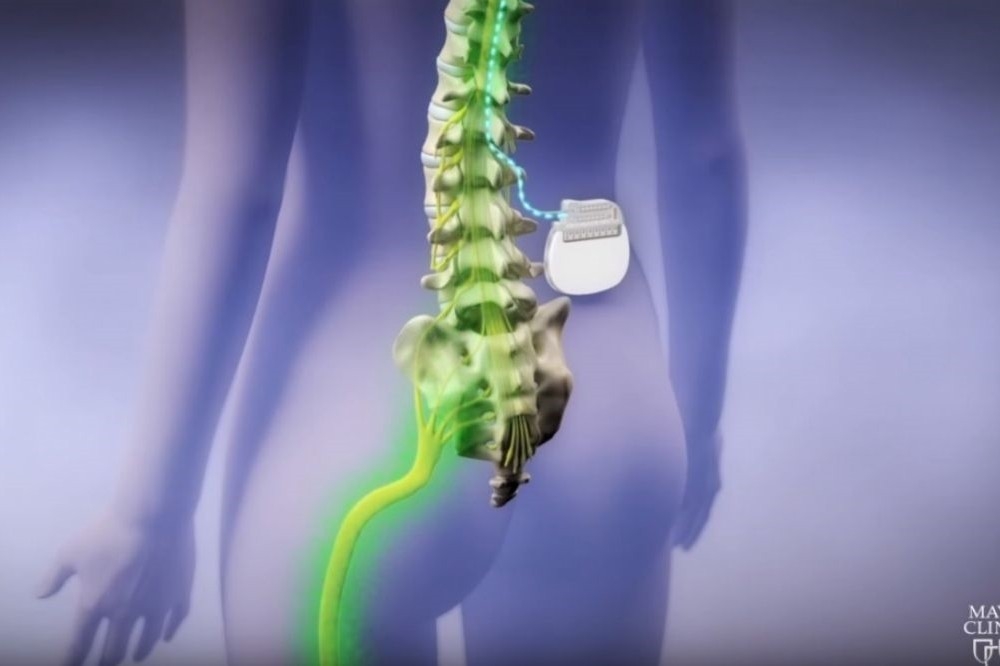 下半身癱瘓病患，可望透過電極脊隨治療，取得再次行走的機會。（翻攝自Youtube）