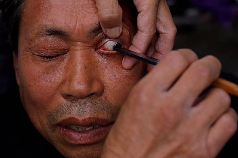 四川有一名間療法利用刀片刮眼瞼治療乾眼症。（湯森路透）