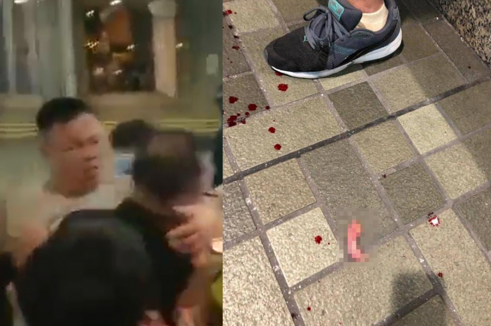 1男子(左穿灰衣者）持刀襲擊在太古城的示威民眾，至少3人中刀，另1人被咬斷左耳。（telegram 抗爭群組圖片）