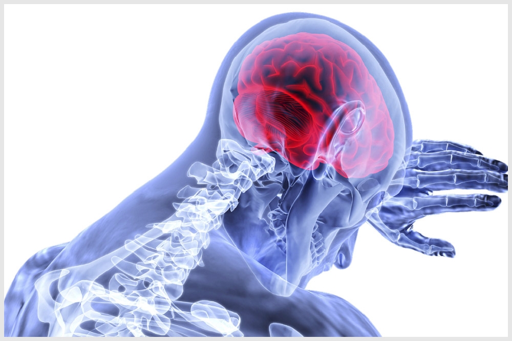 牛津研究指出，便祕藥可望改善認知障礙與增強記憶力。示意圖。（pixabay） 