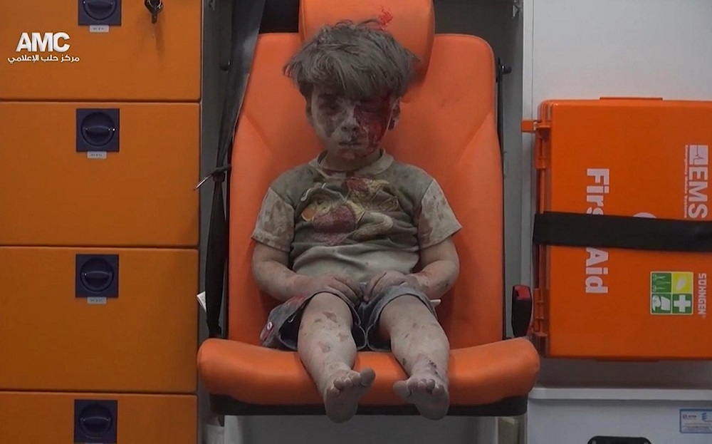 敘利亞空襲不斷，獲救男童慘樣令人心疼。（美聯社）