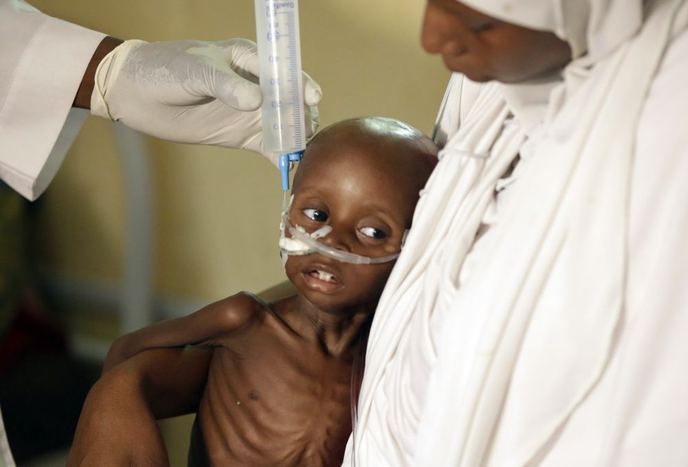 博科哈蘭打亂食物生產，奈國兒童嚴重營養不良。（美聯社）