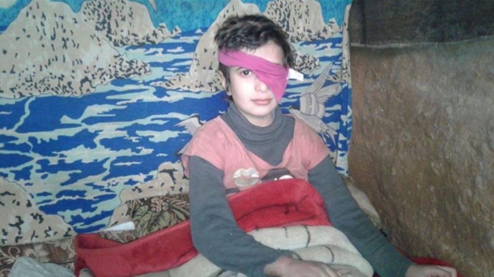 10歲的敘利亞小女孩沙欣（Hala Shaheen）用粉紅色的布條掩住了全盲的左眼。（翻攝自半島電視台）