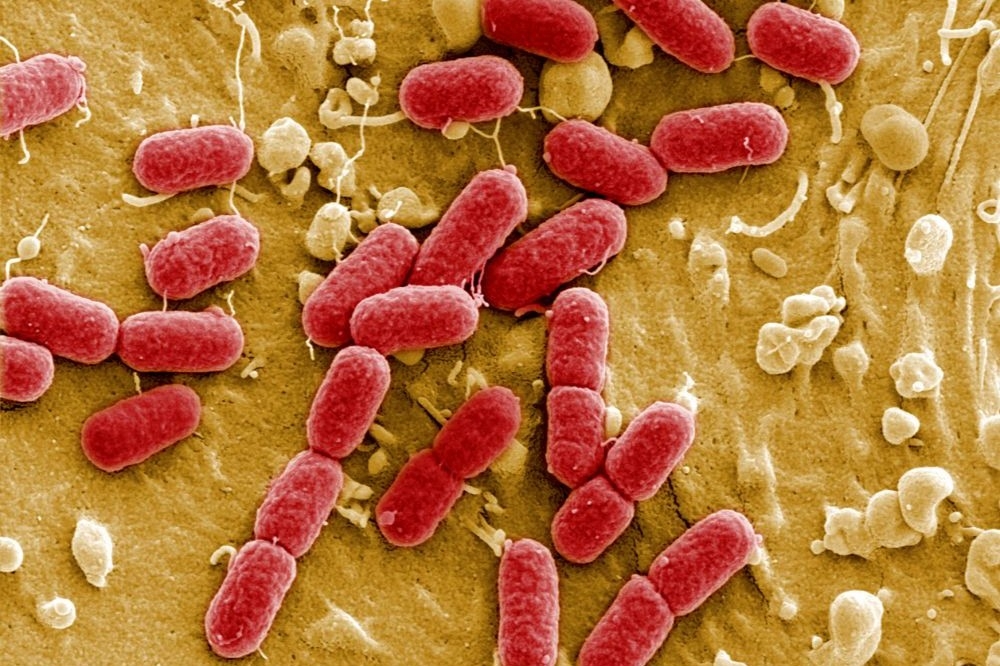 世界衛生組織（WHO）27日公布12種對人類健康構成最大威脅的細菌，指明這些細菌已對大量抗生素產生耐藥性，必須盡快研發新抗生素。（湯森路透）