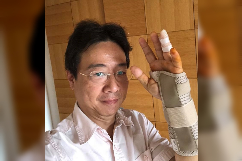 張正傑在臉書表示自己出車禍，左手手腕斷掉。（圖片取自張正傑臉書）