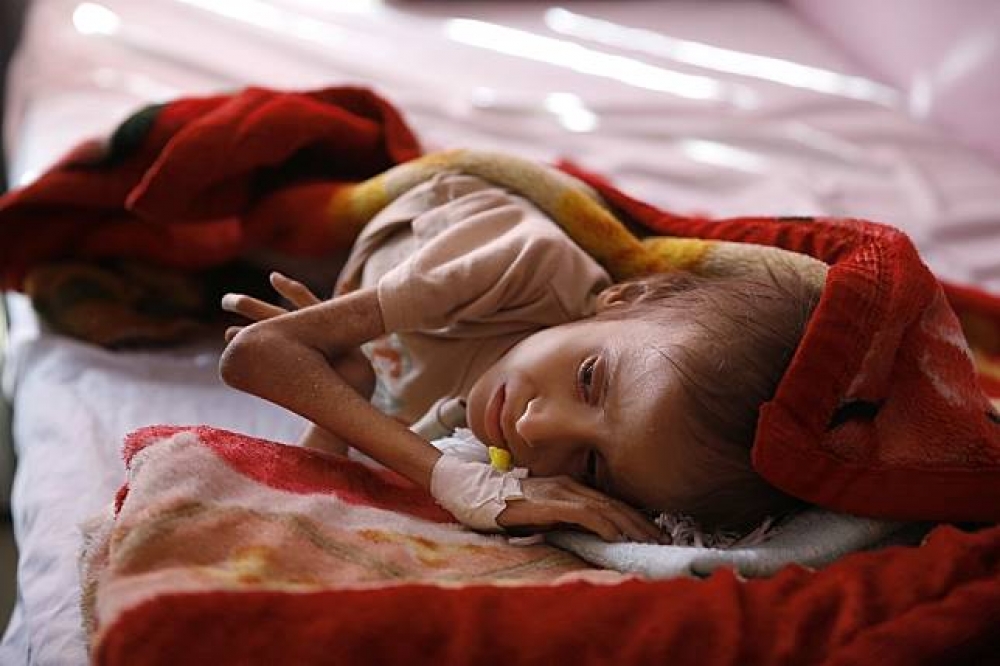 聯合國日前警告，若各界再不有所行動，葉門恐發生數十年世界最大規模的饑荒。（湯森路透）