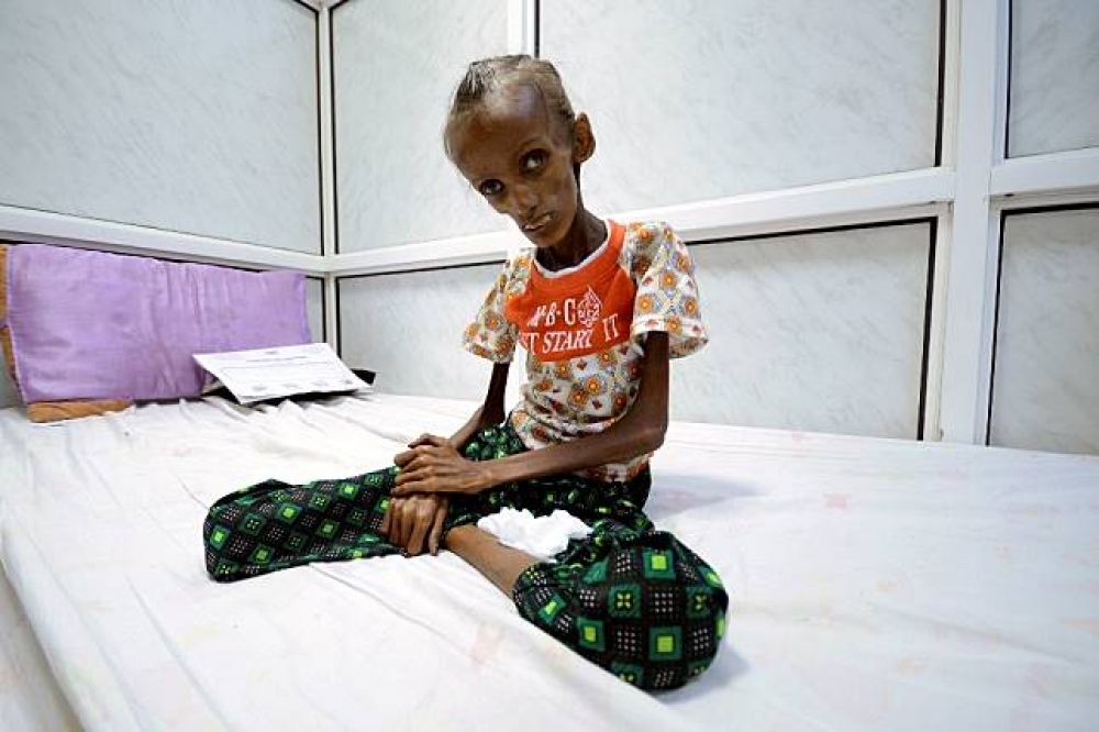 葉門遭沙國全面封鎖，其境內孩童可能將面臨餓死和病死的危機。（湯森路透）