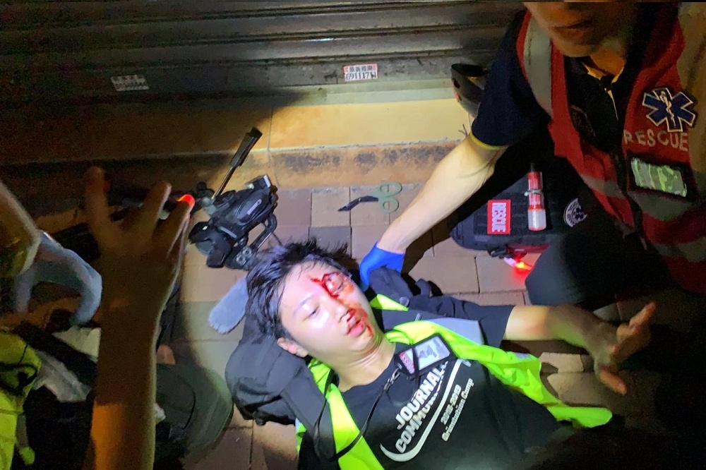 香港記者5日晚間遭警方發射的催淚彈擊中倒地受傷。（取自臉書）