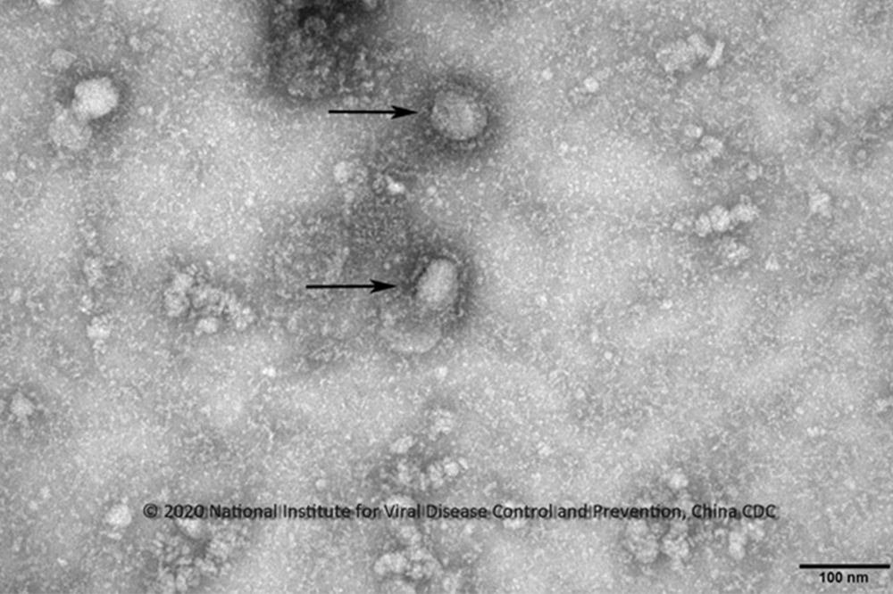 中國政府12日公布武漢肺炎病毒基因序列，病毒圖像更首次曝光。 （翻攝IVDC, China CDC）
