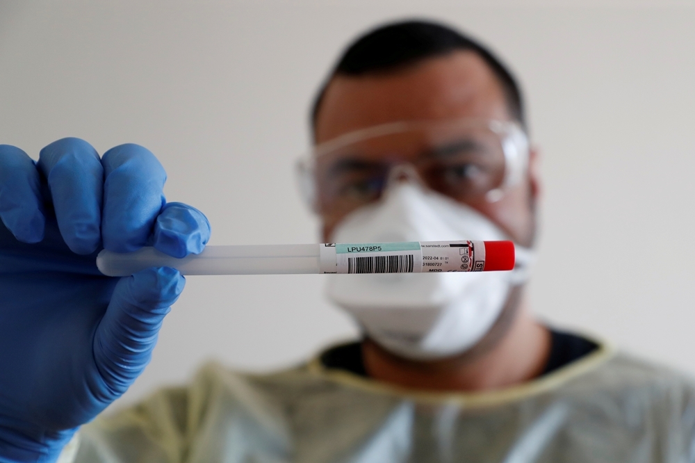 德國柏林一名醫療人員展示一個裝過新型冠狀病毒檢體的容器（湯森路透）