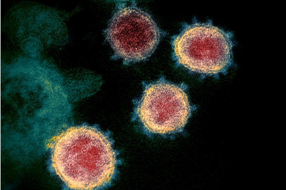 新冠病毒在穿透式電子顯微鏡下現形，可見病毒表現突起的棘冠。因新冠病毒是 RNA 病毒，突變速度快。中研院團隊將目前新冠病毒變異分為六大類型，目前全球流傳的幾乎都是第六類型病毒，未來團隊將持續追蹤病毒變異。（圖片取自維基百科）