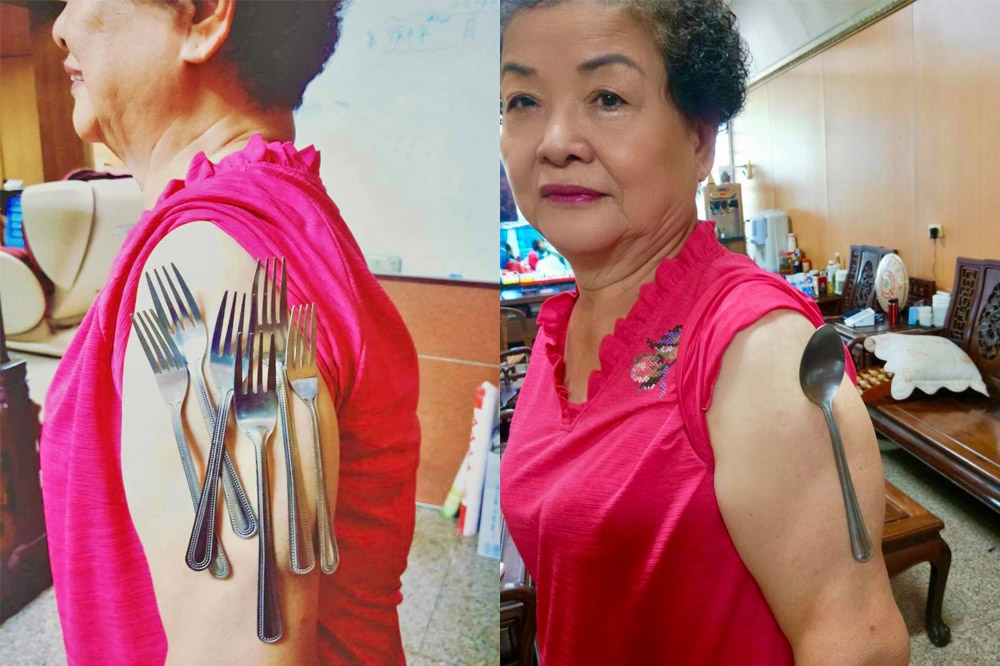 國民黨立委楊瓊瓔在臉書分享母親打完疫苗吸附「鐵叉子」的照片，讓她直呼「楊媽媽要變成行走的餐具架了嗎」。