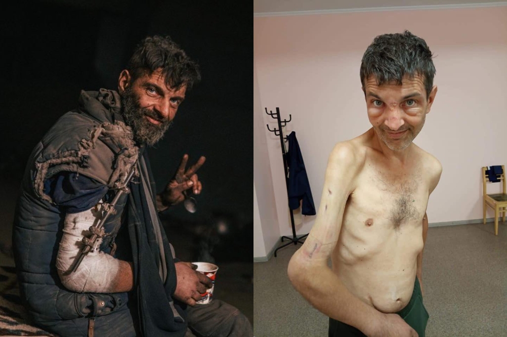 死守亞速廠士兵迪亞諾夫獲釋後已瘦成皮包骨（取自推特@KyivIndependent）