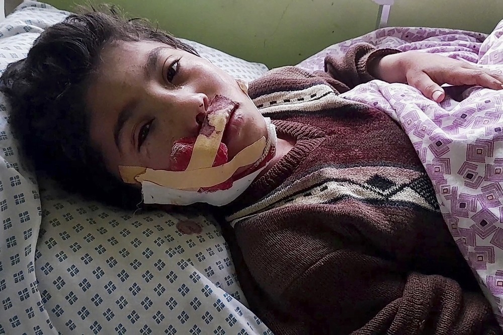 在炸弹攻击过后，大批伤者被送往医院救治，其中多为年轻人与孩童。（美联社）(photo:UpMedia)